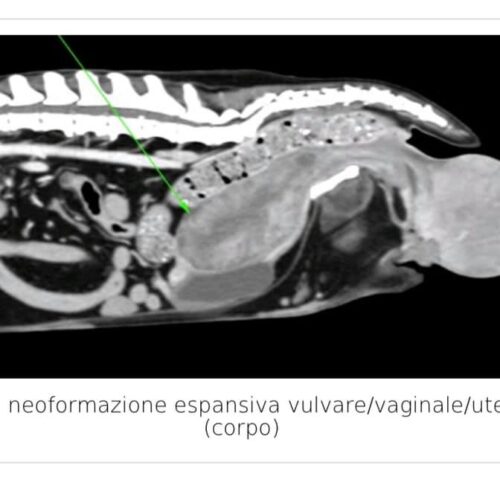 Neoformazione espansiva vulvare